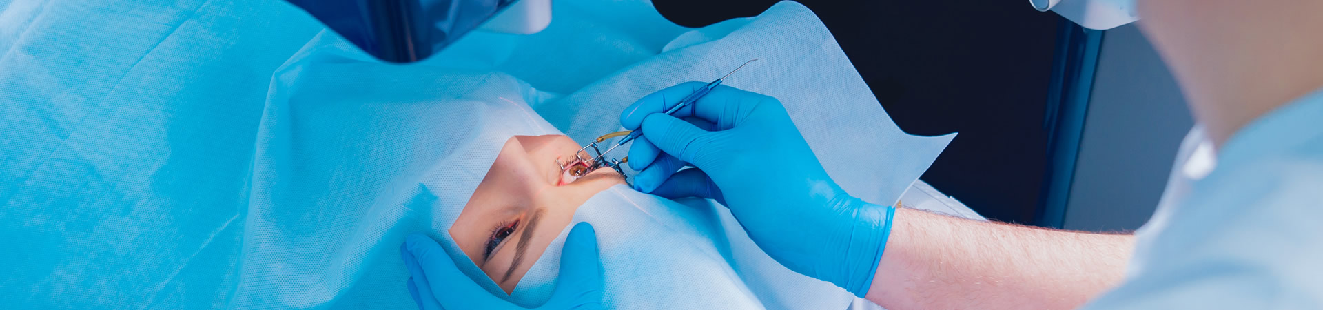 Chirurgia refrattiva